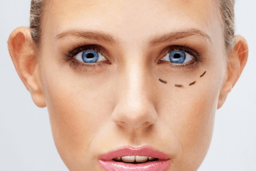 One in five patients unaware of cosmetic surgery risks, study finds